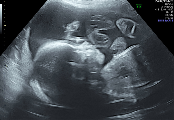Private 20-24 week Anomaly Ultrasound Scan