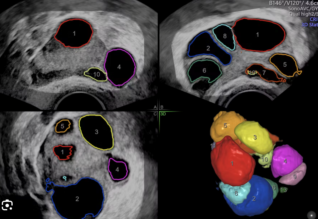 Private Fertility and Follicle Tracking Scans