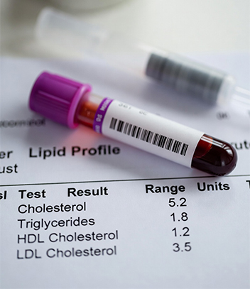 Private Cholesterol Testing