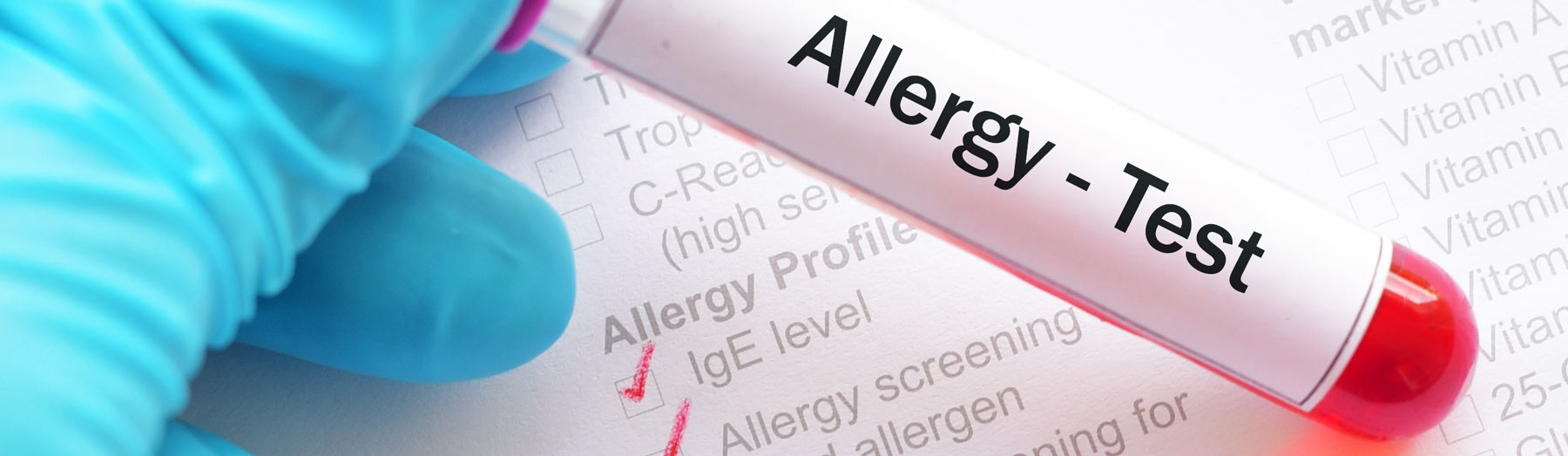 Alex 2 Allergy Test