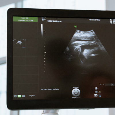 Private Early Pregnancy Ultrasound Scans article on MUMS - Midland Health and Medical Services