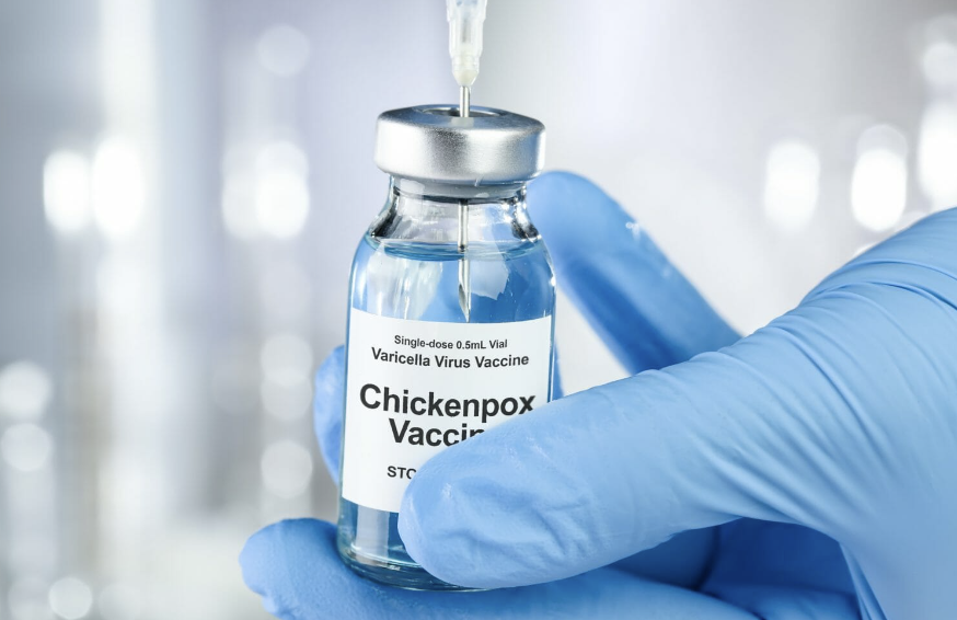 Chicken Pox Vaccine available at MUMS Solihull