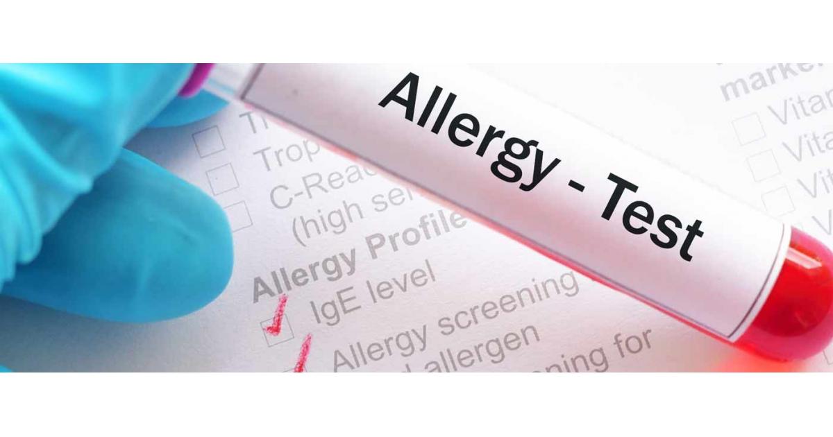 Private Allergy Testing
