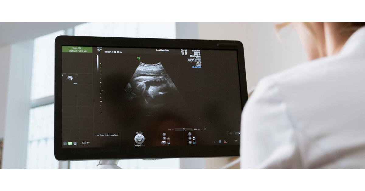 Private Early Pregnancy Ultrasound Scans